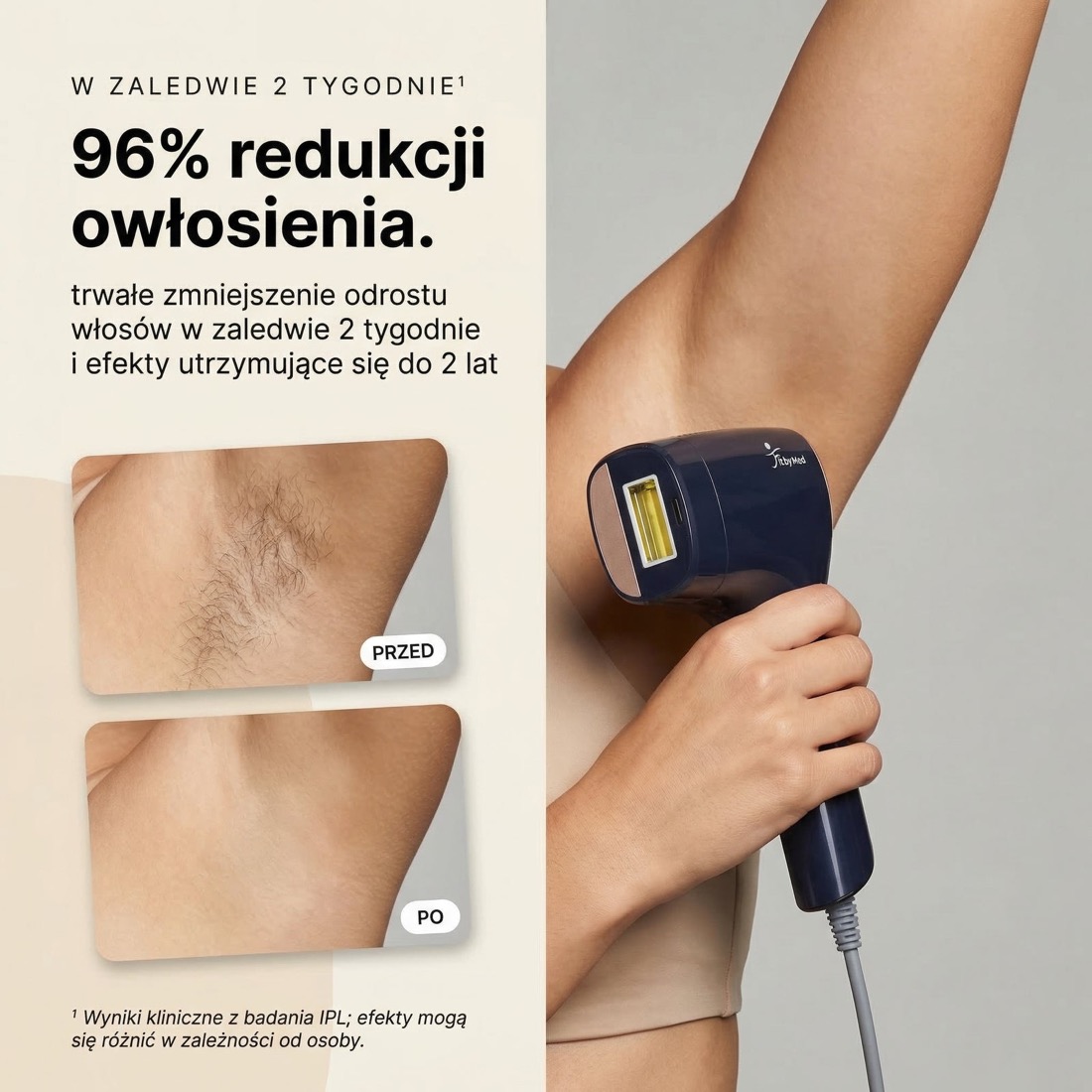 Efekt przed i po — redukcja widoczności owłosienia pod pachami